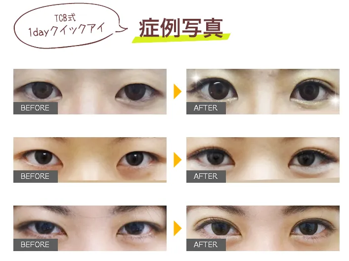 特集サブ画像